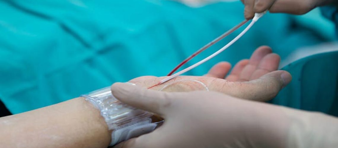 جراحی محیطی عروقی در شیراز